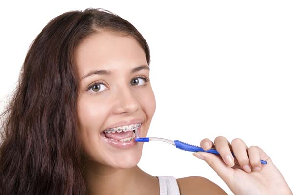 Braces For Teens: What Are Your Options?