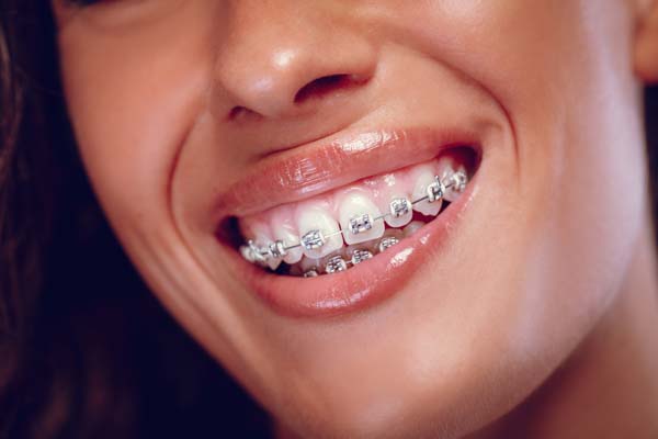 Guide To Your First Orthodontist Visit
